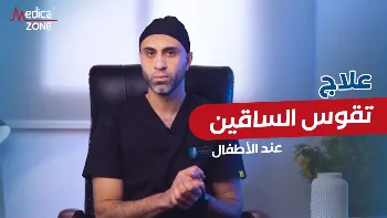 طرق علاج تقوس الساقين عند الاطفال